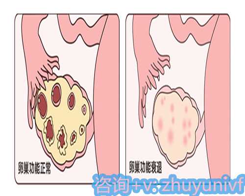 供卵代怀咨询中心,石家庄助孕费用